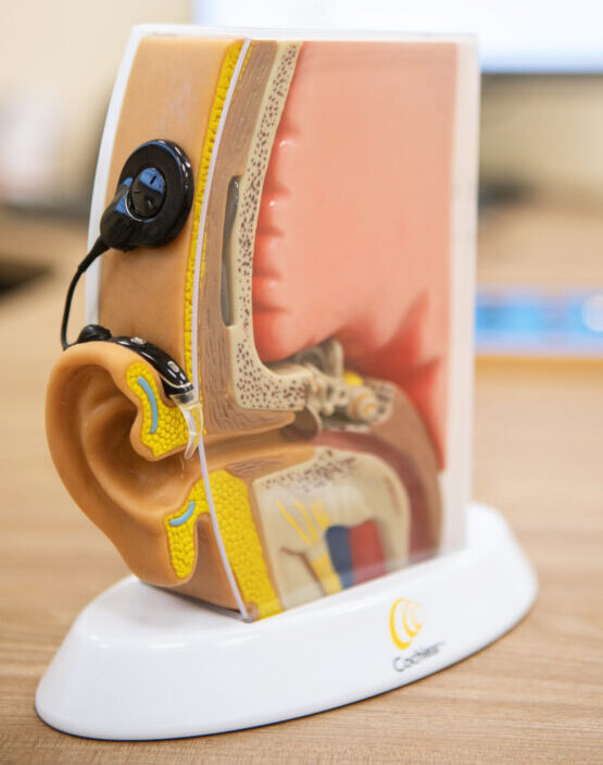 Hörimplantate CI Cochlea Implantate Service Partner Bayreuth
